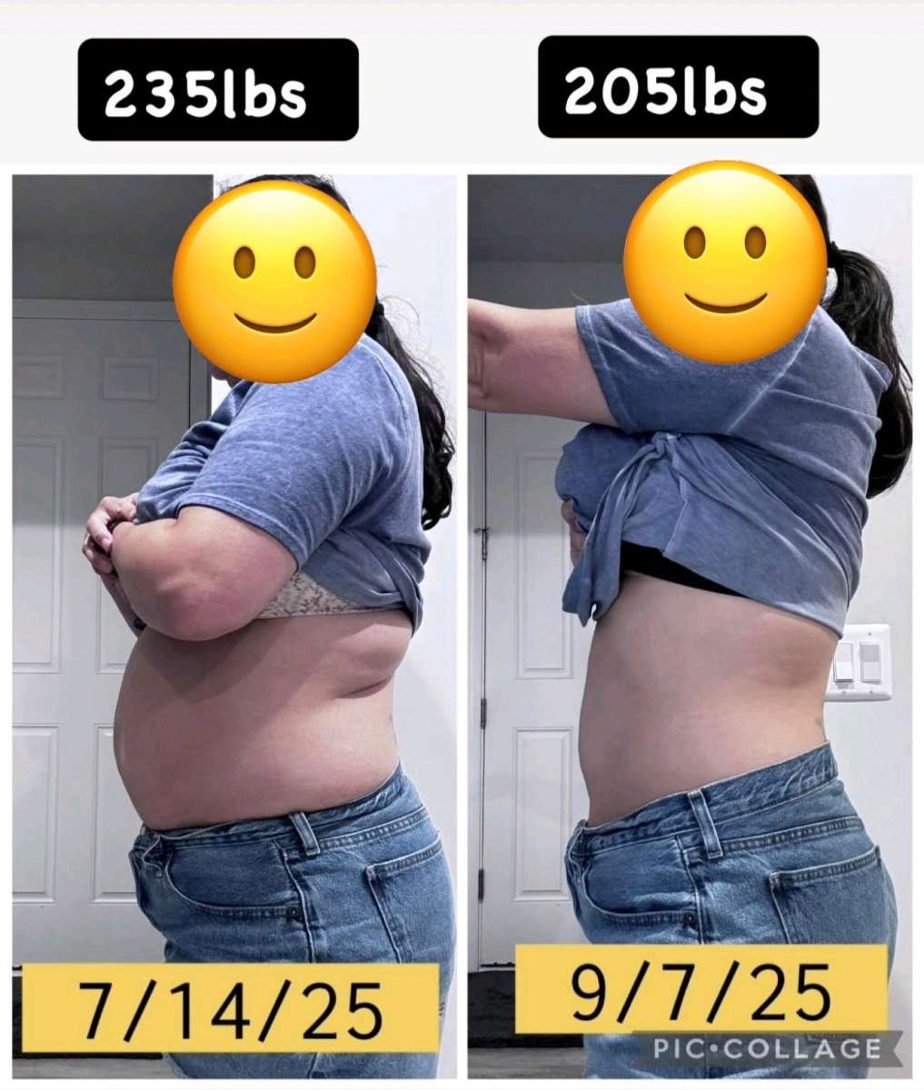 Weight Loss