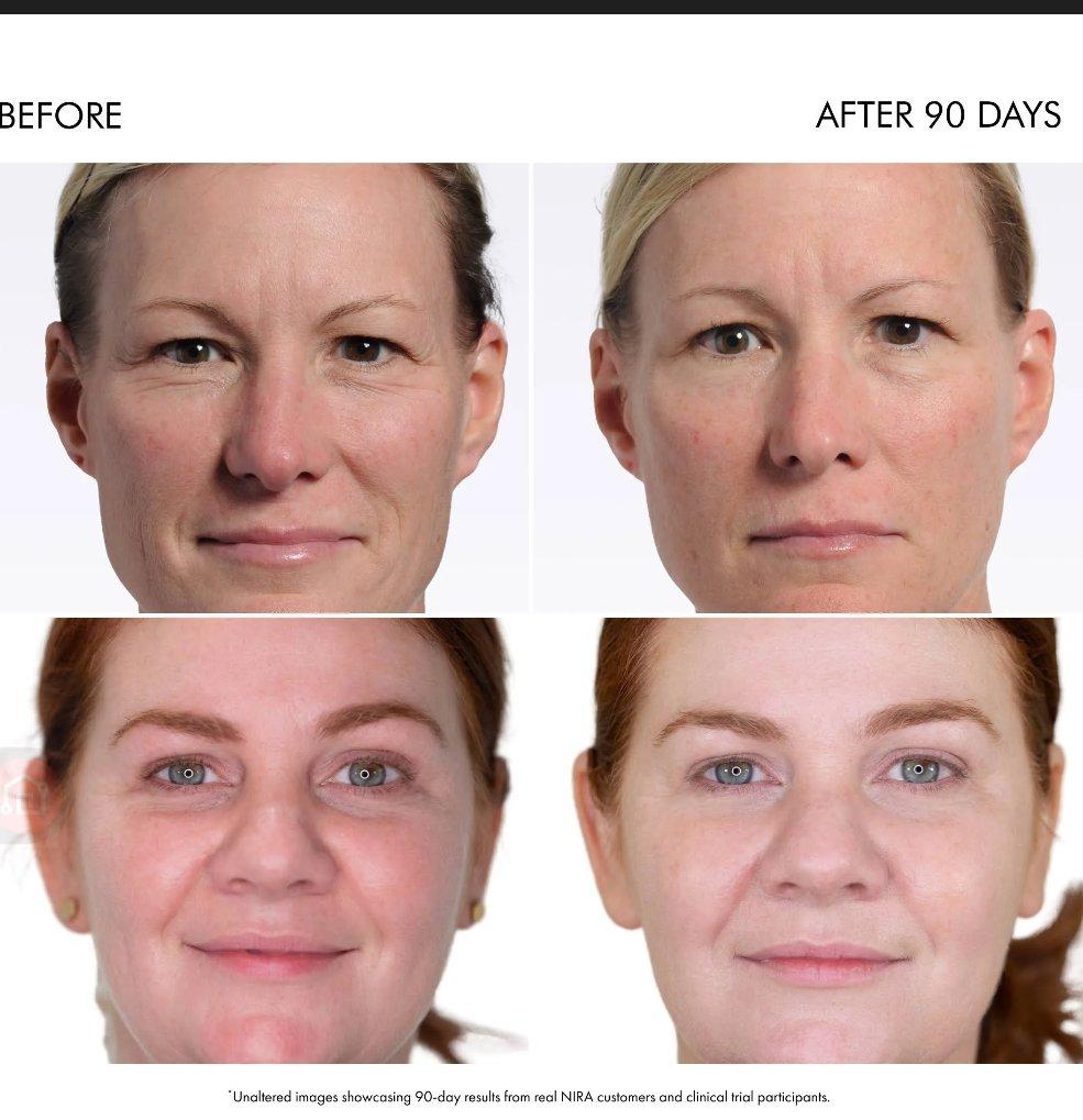 NIRA PRO ANTi AGING LASER