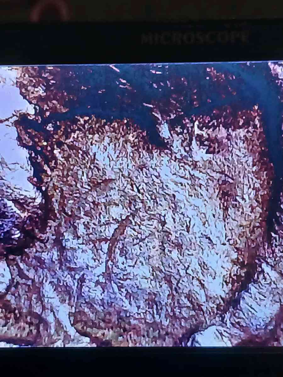 Buffalo Nickel with Die Clash no date - Bakersfield, California - FleaMarketBay