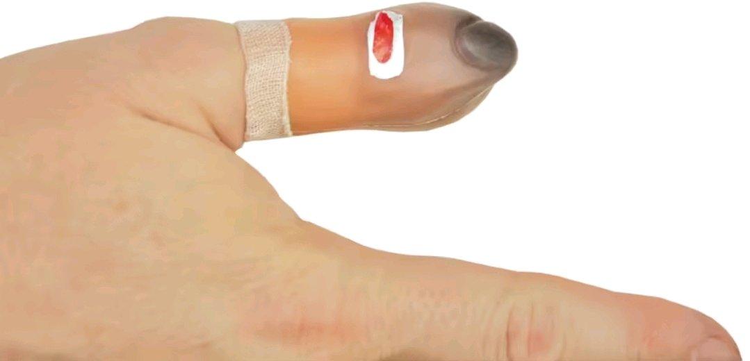 Bruised Thumb - Angleton, Texas - FleaMarketBay