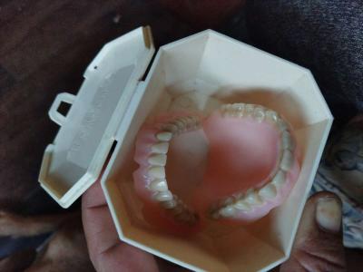 dentures - Thumbnail 2