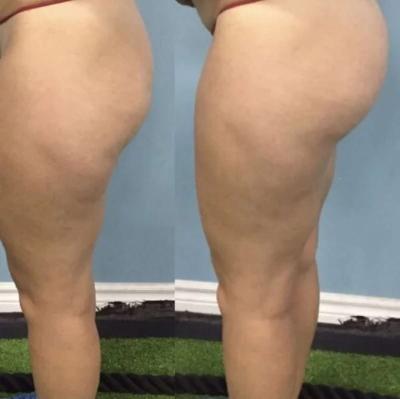 bigger booty oil - Thumbnail 2