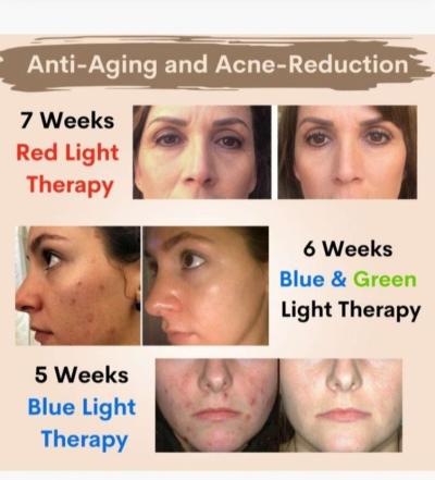 VogueNow Dermawave Photon Mask - Thumbnail 4