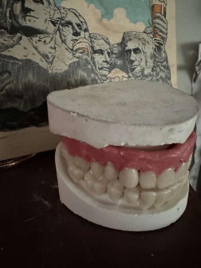 Unused Custom Designed Universal Unisex Dentures - Thumbnail 2