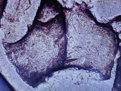 Buffalo Nickel with Die Clash no date - Thumbnail 5