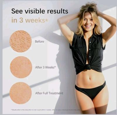 Depiladora Lser - Thumbnail 2